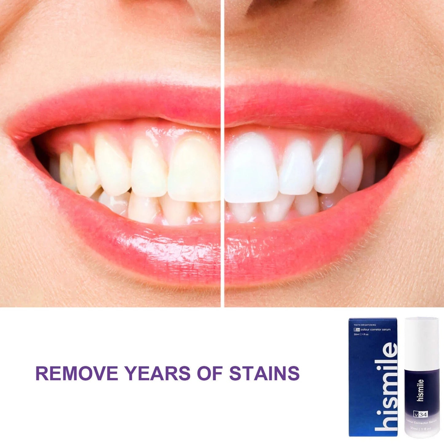🦷 Hismile - The Serum That Turns Yellow Into Radiant White