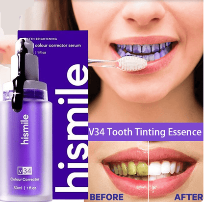 🦷 Hismile - The Serum That Turns Yellow Into Radiant White