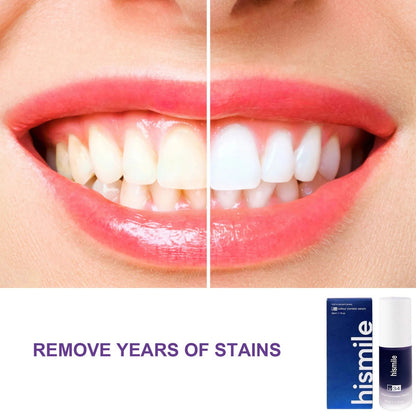 🦷 Hismile - The Serum That Turns Yellow Into Radiant White
